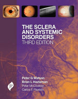 The Sclera and Systemic Disorders